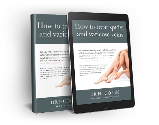 How to treat Spider and Varicose Veins