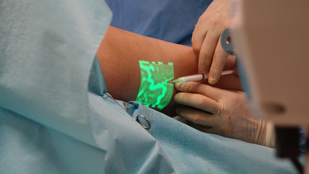 Varicose Veins removal Caboolture