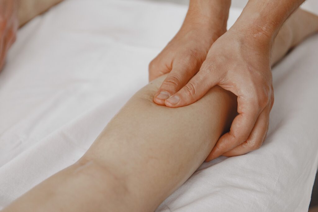 Varicose Veins treatment