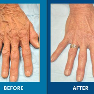 hands before and after